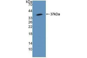 Detection of Recombinant SQSTM1, Human using Polyclonal Antibody to Sequestosome 1 (SQSTM1)