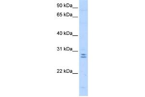 WB Suggested Anti-MED4 Antibody Titration:  0. (MED4 抗体  (C-Term))