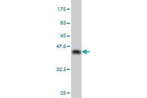 Western Blot detection against Immunogen (36. (CRYBB1 抗体  (AA 37-137))