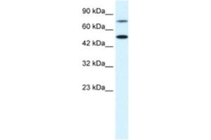 Western Blotting (WB) image for anti-Choroideremia-Like (Rab Escort Protein 2) (CHML) antibody (ABIN2463728) (CHML 抗体)