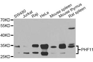 Western blot analysis of extracts of various cell lines, using PHF11 Antibody (ABIN5975729) at 1/1000 dilution. (PHF11 抗体)