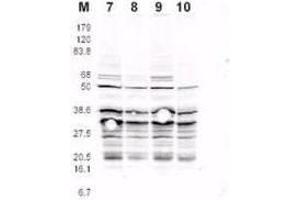 This product was assayed by western blotting against RFA2 containing cell lysates. (RPA2 抗体  (pSer122))
