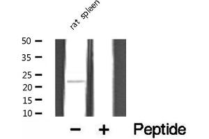 Western blot analysis of extracts from rat spleen, using TUSC5 antibody. (TUSC5 抗体  (N-Term))