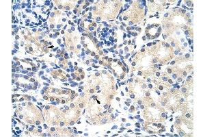 PABPC4 antibody was used for immunohistochemistry at a concentration of 4-8 ug/ml to stain Epithelial cells of renal tubule (arrows) in Human Kidney. (PABPC4 抗体  (N-Term))