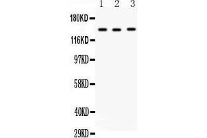 Western Blotting (WB) image for anti-Angiotensin I Converting Enzyme (Peptidyl-Dipeptidase A) 1 (ACE) (AA 702-715), (Middle Region) antibody (ABIN3042841)