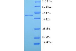 SDS-PAGE (SDS) image for H2A Histone Family, Member J (H2AFJ) (AA 2-129) protein (GST tag) (ABIN5709637)