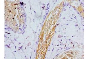 Immunohistochemistry of paraffin-embedded human epityphlon tissue using ABIN7164263 at dilution of 1:100 (Presenilin 1 抗体  (AA 1-160))