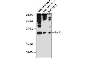 Western blot analysis of extracts of various cell lines, using RNF4 antibody (ABIN6129121, ABIN6147041, ABIN6147042 and ABIN6215602) at 1:3000 dilution. (RNF4 抗体  (AA 1-190))