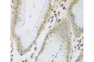 Immunohistochemistry of paraffin-embedded Human stomach using ENPEP Polyclonal Antibody at dilution of 1:200 (40x lens). (ENPEP 抗体)