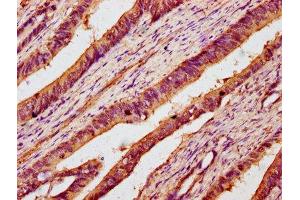 Immunohistochemistry (IHC) image for anti-UDP-GlcNAc:betaGal beta-1,3-N-Acetylglucosaminyltransferase 6 (Core 3 Synthase) (B3GNT6) (AA 251-345) antibody (ABIN7142974)
