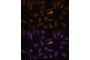 Immunofluorescence analysis of U-2 OS cells using RGS4 antibody (ABIN7269898) at dilution of 1:100. (RGS4 抗体  (AA 1-100))