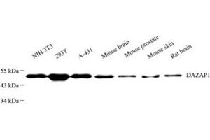 Western blot analysis of DAZAP1 (ABIN7073691) at dilution of 1: 2000 (DAZAP1 抗体)