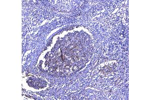 IHC analysis of TAPA1 using anti-TAPA1 antibody . (CD81 抗体  (AA 113-201))
