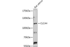 Western blot analysis of extracts of Rat uterus, using CLC antibody (ABIN7266332) at 1:1000 dilution. (CLCA4 抗体  (AA 22-150))