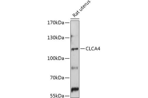 CLCA4 抗体  (AA 22-150)