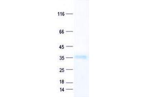Western Blotting (WB) image for Transcriptional Adaptor 2A (TADA2A) protein (His tag) (ABIN5505791)