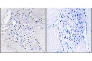 Immunohistochemistry analysis of paraffin-embedded human thyroid gland tissue, using C9orf89 Antibody. (C9orf89 抗体  (AA 21-70))