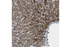 Immunohistochemical staining (Formalin-fixed paraffin-embedded sections) of human liver with SIGLEC14 polyclonal antibody  shows strong cytoplasmic positivity in a granular pattern in hepatocytes at 1:20-1:50 dilution.