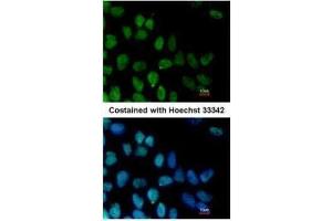 ICC/IF Image Immunofluorescence analysis of paraformaldehyde-fixed Human ESC, using ZNF281, antibody at 1:100 dilution. (ZNF281 抗体)