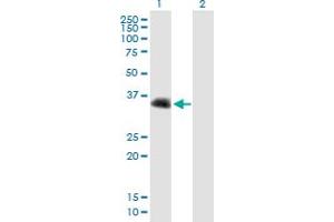 Western Blot analysis of CENPV expression in transfected 293T cell line by CENPV MaxPab polyclonal antibody. (CENPV 抗体  (AA 1-275))
