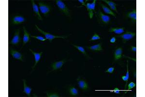 Immunofluorescence of monoclonal antibody to SIK2 on HeLa cell. (SIK2 抗体  (AA 467-576))