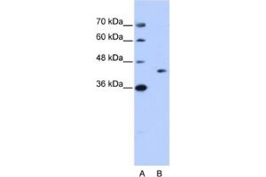 Western Blotting (WB) image for anti-GIPC PDZ Domain Containing Family, Member 1 (GIPC1) antibody (ABIN2462192) (GIPC1 抗体)