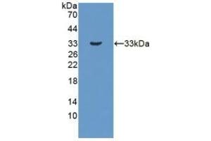 Detection of Recombinant HSD17b3, Human using Polyclonal Antibody to 17-Beta-Hydroxysteroid Dehydrogenase Type 3 (HSD17b3) (HSD17B3 抗体  (AA 1-310))
