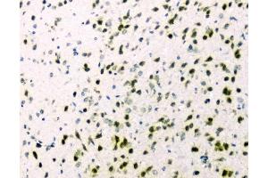 IHC analysis of hnRNP A2B1 using anti-hnRNP A2B1 antibody (ABIN5692872). (HNRNPA2B1 抗体)
