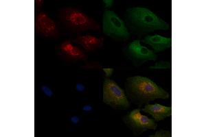 ABIN6258933 and ABIN6275175 staining  cells by IF/ICC.