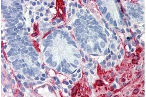 Human Small Intestine: Formalin-Fixed, Paraffin-Embedded (FFPE) (Filamin A 抗体  (AA 1-839))