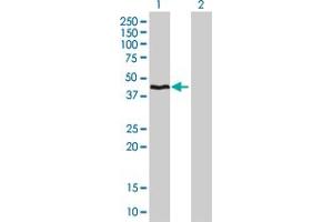 Western Blot analysis of HMBS expression in transfected 293T cell line by HMBS monoclonal antibody (M01), clone 3E8. (HMBS 抗体  (AA 1-361))