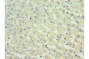 Immunohistochemistry of paraffin-embedded human liver tissue using ABIN7171013 at dilution of 1:100 (SUFUH 抗体  (AA 325-484))