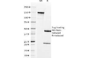 SDS-PAGE Analysis Purified Prolactin Receptor Mouse Monoclonal Antibody (B6. (Prolactin Receptor 抗体)