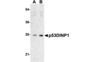 Western Blotting (WB) image for anti-Tumor Protein P53 Inducible Nuclear Protein 1 (TP53INP1) (N-Term) antibody (ABIN1031500) (TP53INP1 抗体  (N-Term))