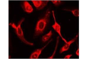 Immunocytochemical staining of HeLa Cells (FAS 抗体  (N-Term))