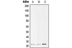 Western blot analysis of UBE2T expression in Jurkat (A), HepG2 (B), HeLa (C) whole cell lysates. (Ube2t 抗体  (Center))