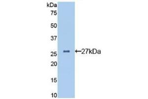 Detection of Recombinant CLU, Mouse using Polyclonal Antibody to Clusterin (CLU) (Clusterin 抗体  (AA 227-448))