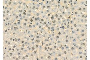 ABIN6258570 and ABIN6274563 at 1/100 staining Rat liver tissue by IHC-P. (YWHAE 抗体  (C-Term))
