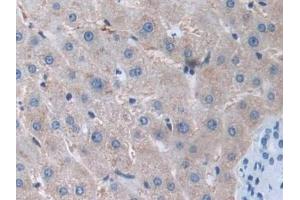 DAB staining on IHC-P; Samples: Human Liver Tissue (MMP15 抗体  (AA 280-497))