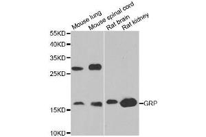 Western blot analysis of extracts of various cell lines, using GRP antibody. (Gastrin-Releasing Peptide 抗体  (AA 1-148))