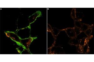 Live cell imaging of MmTx1 Toxin-ATTO Fluor-488 in intact human  cells expressing GABRB3. (MmTx1 Toxin peptide (Atto 488))