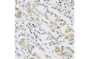 Immunohistochemistry of paraffin-embedded human stomach using RETN antibody at dilution of 1:100 (40x lens). (Resistin 抗体)