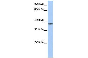 TMCC1 antibody used at 1 ug/ml to detect target protein. (TMCC1 抗体  (C-Term))