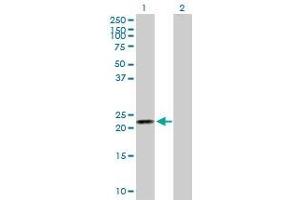 Lane 1: RBP4 transfected lysate ( 22. (RBP4 293T Cell Transient Overexpression Lysate(Denatured))