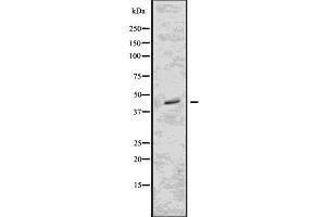 Western blot analysis of FCGR2B using Jurkat whole  lysates.