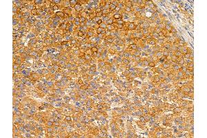 ABIN6256968 and ABIN6274914 at 1/100 staining Rat ovarian tissue by IHC-P.