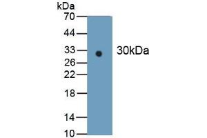 Detection of Recombinant IDH1, Human using Monoclonal Antibody to Isocitrate Dehydrogenase 1, Soluble (IDH1) (IDH1 抗体  (AA 74-333))
