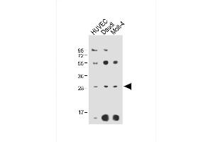 All lanes : Anti-RPS4Y1 Antibody (Center) at 1:2000 dilution Lane 1: HUVEC whole cell lysate Lane 2: Daudi whole cell lysate Lane 3: Molt-4 whole cell lysate Lysates/proteins at 20 μg per lane.