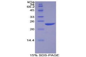 SDS-PAGE analysis of Human NOS1 Protein. (NOS1 蛋白)