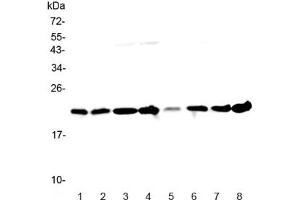 Western blot testing of human 1) HeLa, 2) placenta, 3) MCF7, 4) COLO320, 5) 22RV1, 6) HepG2, 7) A431 and 8) U937 lysate with GLO1 antibody at 0. (GLO1 抗体)